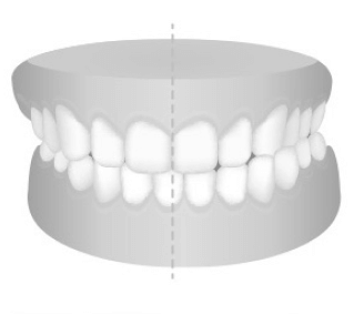 cross-bite