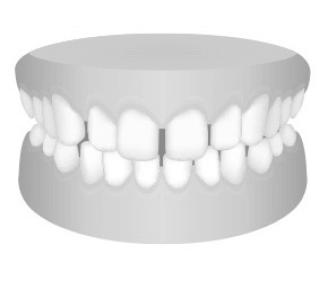 gapped-teeth