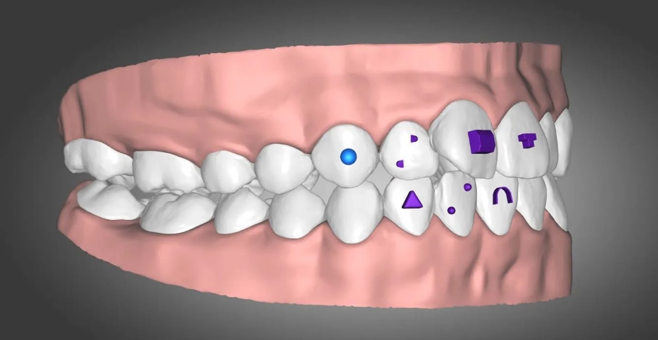 consultation-with-a-dentist